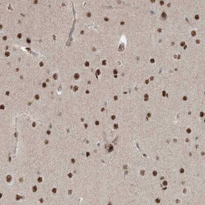 Immunohistochemistry-Paraffin: ZNF711 Antibody [NBP1-85538]