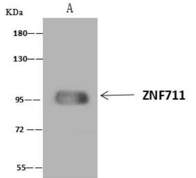 Immunoprecipitation: ZNF711 Antibody [NBP3-12580]
