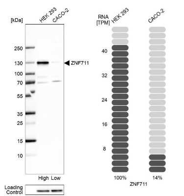 Western Blot: ZNF711 Antibody [NBP1-85538]