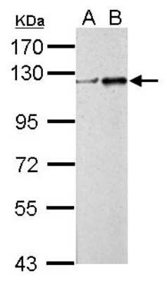 Western Blot: ZNF711 Antibody [NBP2-21045]