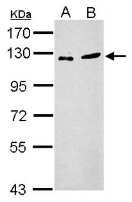 Western Blot: ZNF711 Antibody [NBP2-21045]