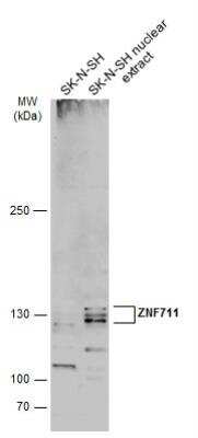 Western Blot: ZNF711 Antibody [NBP2-21046]