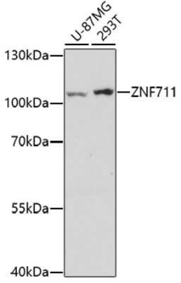 Western Blot: ZNF711 AntibodyAzide and BSA Free [NBP2-94844]