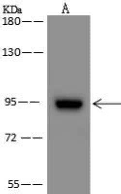 Western Blot: ZNF711 Antibody [NBP3-12580]