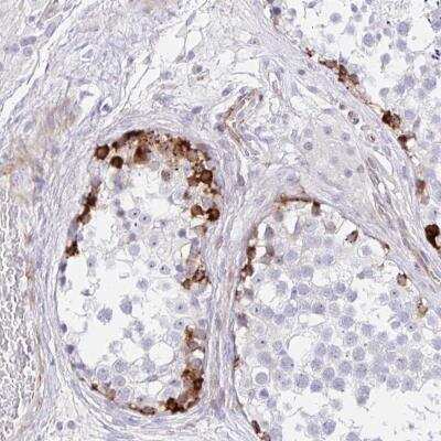 Immunohistochemistry-Paraffin: ZNF713 Antibody [NBP2-31767]