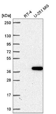 Western Blot: ZNF713 Antibody [NBP2-56245]