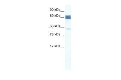 Western Blot: ZNF713 Antibody [NBP2-86552]