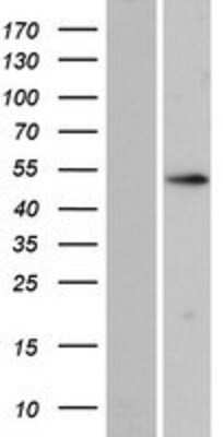 Western Blot: ZNF713 Overexpression Lysate [NBP2-04824]