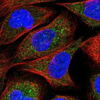 Immunocytochemistry/ Immunofluorescence: ZNF720 Antibody [NBP1-86224]