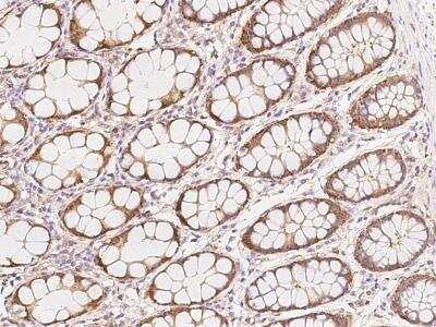 Immunohistochemistry-Paraffin: ZNF720 Antibody [NBP3-06053]