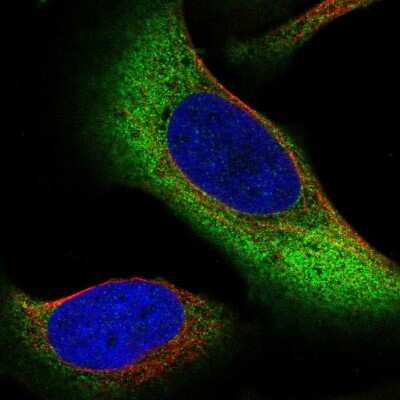 Immunocytochemistry/ Immunofluorescence: ZNF721 Antibody [NBP2-55790]