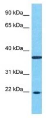 Western Blot: ZNF726 Antibody [NBP3-09927]