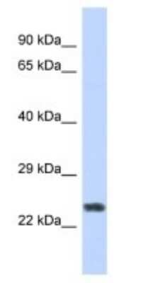 Western Blot: ZNF732 Antibody [NBP3-09195]