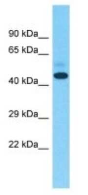 Western Blot: ZNF735 Antibody [NBP3-09201]