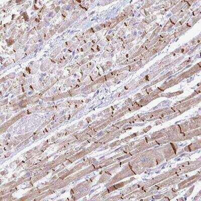 Immunohistochemistry-Paraffin: ZNF736 Antibody [NBP2-32587]