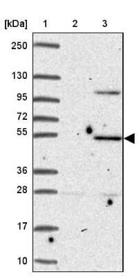 Western Blot: ZNF736 Antibody [NBP2-32587]