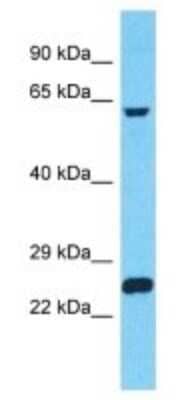 Western Blot: ZNF737 Antibody [NBP3-09926]