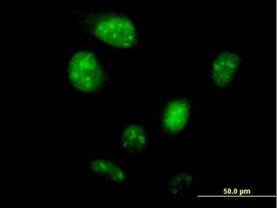 Immunocytochemistry/ Immunofluorescence: ZNF738 Antibody [H00148203-B01P]