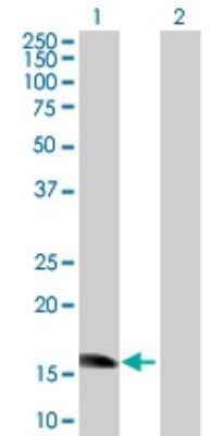 Western Blot: ZNF738 Antibody [H00148203-B01P]