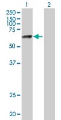 Western Blot: ZNF74 Antibody [H00007625-B01P]