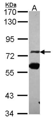 Western Blot: ZNF74 Antibody [NBP2-21047]