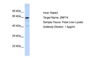 Western Blot: ZNF74 Antibody [NBP2-88733]