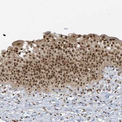 Immunohistochemistry-Paraffin: ZNF740 Antibody [NBP1-80602]