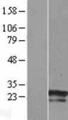 Western Blot: ZNF740 Overexpression Lysate [NBL1-18242]