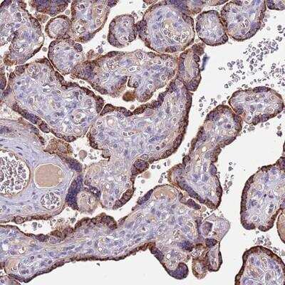 Immunohistochemistry: ZNF746 Antibody [NBP2-13594]