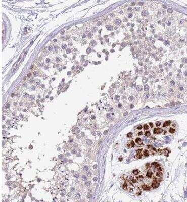 Immunohistochemistry-Paraffin: ZNF746 Antibody [NBP2-13594]