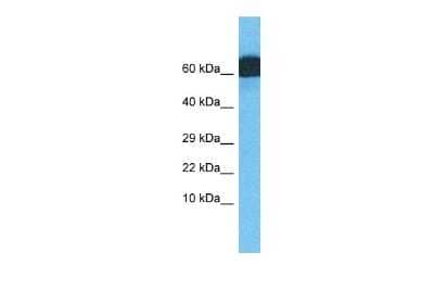 Western Blot: ZNF746 Antibody [NBP2-83902]