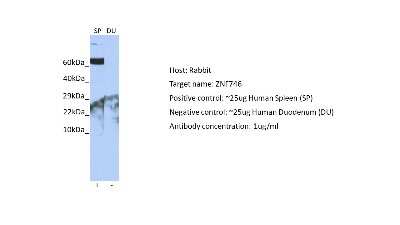 Western Blot: ZNF746 Antibody [NBP2-83902]