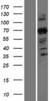 Western Blot: ZNF746 Overexpression Lysate [NBP2-10209]