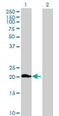 Western Blot: ZNF747 Antibody [H00065988-B01P]