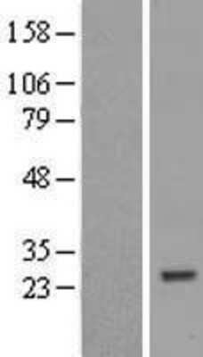 Western Blot: ZNF747 Overexpression Lysate [NBL1-18243]