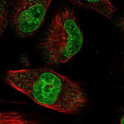 Immunocytochemistry/ Immunofluorescence: ZNF749 Antibody [NBP1-93996]