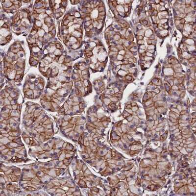 Immunohistochemistry-Paraffin: ZNF749 Antibody [NBP1-93996]