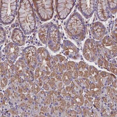 Immunohistochemistry-Paraffin: ZNF749 Antibody [NBP1-93997]