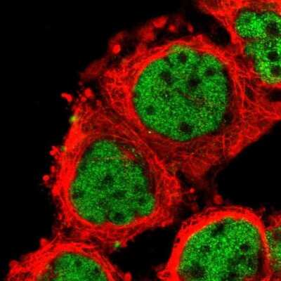 Immunocytochemistry/ Immunofluorescence: ZNF75 Antibody [NBP1-88035]