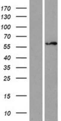 Western Blot: ZNF75 Overexpression Lysate [NBP2-10382]