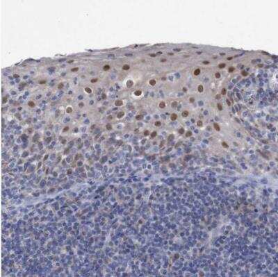 Immunohistochemistry-Paraffin: ZNF750 Antibody [NBP1-82246]