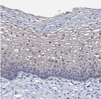 Immunohistochemistry-Paraffin: ZNF750 Antibody [NBP1-82246]