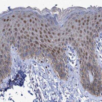 Immunohistochemistry-Paraffin: ZNF750 Antibody [NBP1-82246]