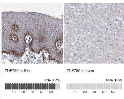 Immunohistochemistry-Paraffin: ZNF750 Antibody [NBP1-82247]