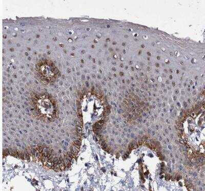 Immunohistochemistry-Paraffin: ZNF750 Antibody [NBP1-82247]
