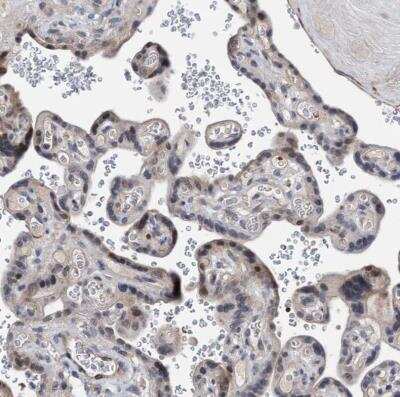 Immunohistochemistry-Paraffin: ZNF750 Antibody [NBP1-82247]