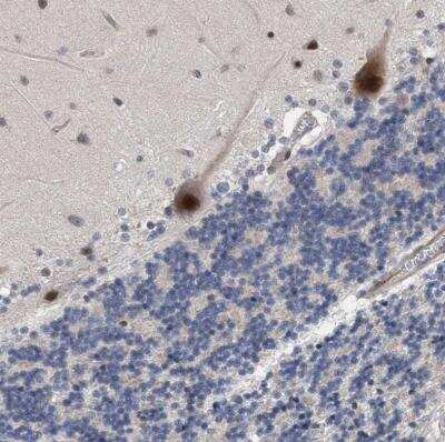 Immunohistochemistry-Paraffin: ZNF750 Antibody [NBP1-82247]