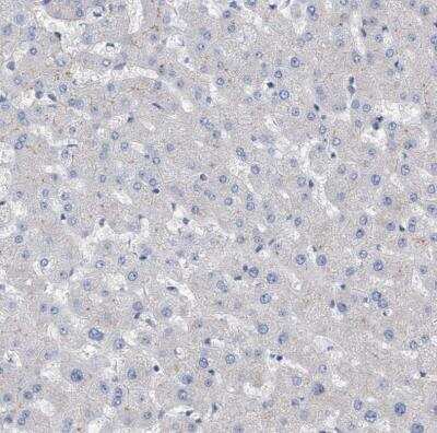 Immunohistochemistry-Paraffin: ZNF750 Antibody [NBP1-82247]