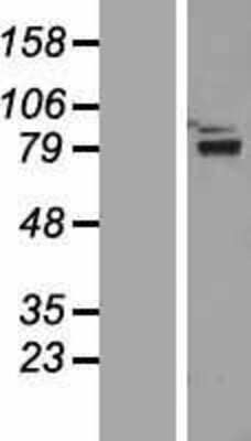 Western Blot: ZNF750 Overexpression Lysate [NBP2-06303]