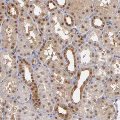 Immunohistochemistry-Paraffin: ZNF75A Antibody [NBP1-82020]